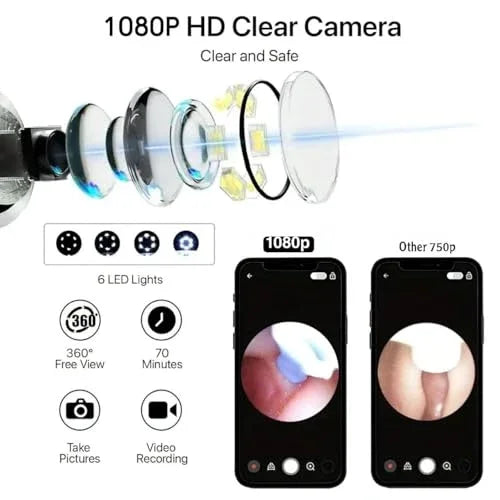 Smart Ear Wax Removal Tool | HD Camera | LED Light | Wireless