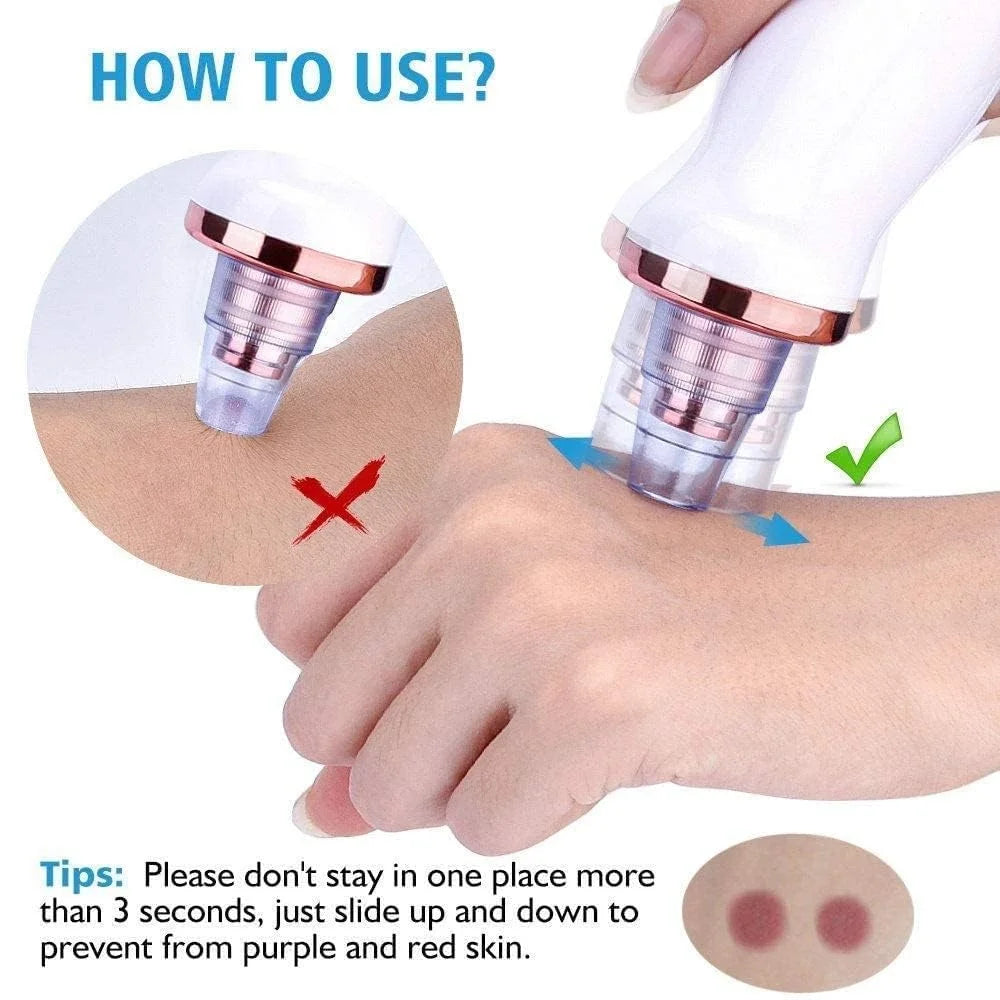 6-in-1 Multi-Functional Blackhead & Pore | Vacuum Suction Technology