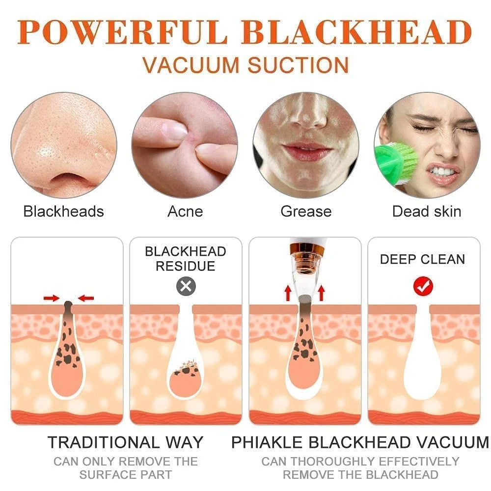 6-in-1 Multi-Functional Blackhead & Pore | Vacuum Suction Technology